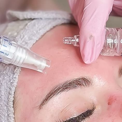 MTS / BB Glow Package at HH Beauty Atelier in Falls Church, VA