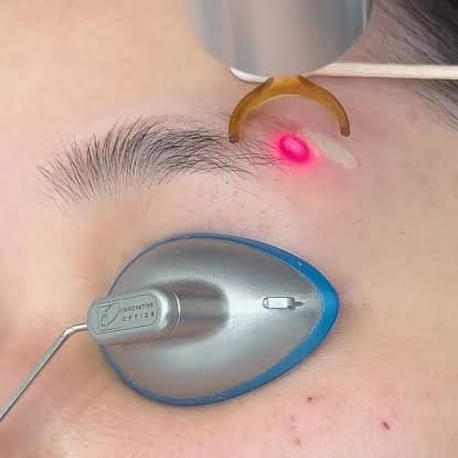 Brows Tattoo Removal at HH Beauty Atelier in Falls Church, VA